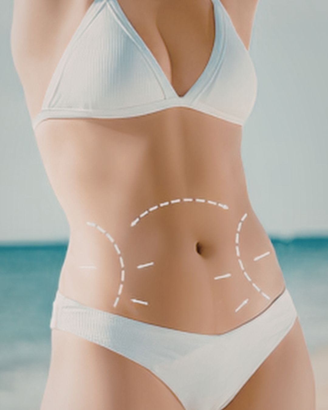 NeveSkin Tone body firming treatment