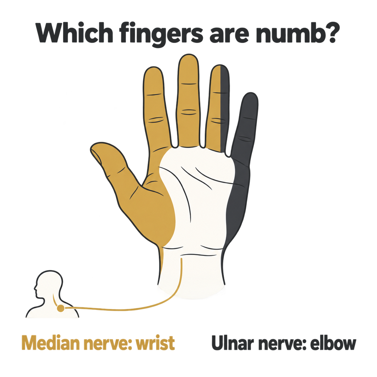 infographic showing which fingers go numb from median nerve and ulnar nerve compression infographic showing which fingers go numb from median nerve and ulnar nerve compression
