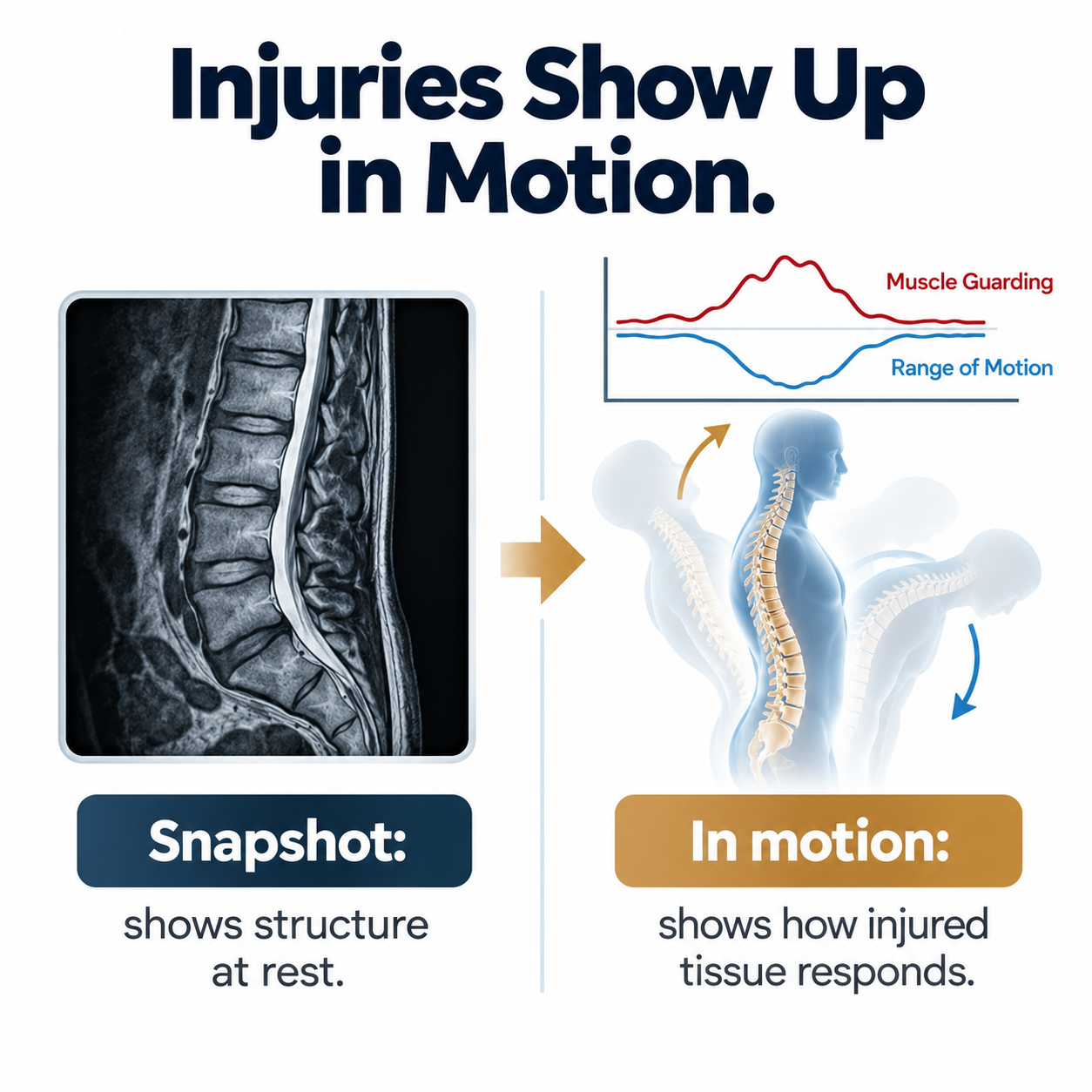 Infographic comparing static imaging like X-ray and MRI with DynaROM motion testing that measures muscle guarding and range of motion for soft tissue injury Infographic comparing static imaging like X-ray and MRI with DynaROM motion testing that measures muscle guarding and range of motion for soft tissue injury