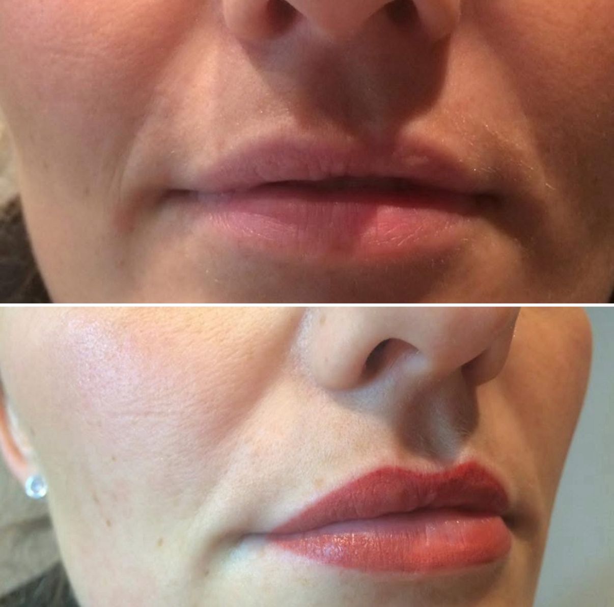 Lips Before