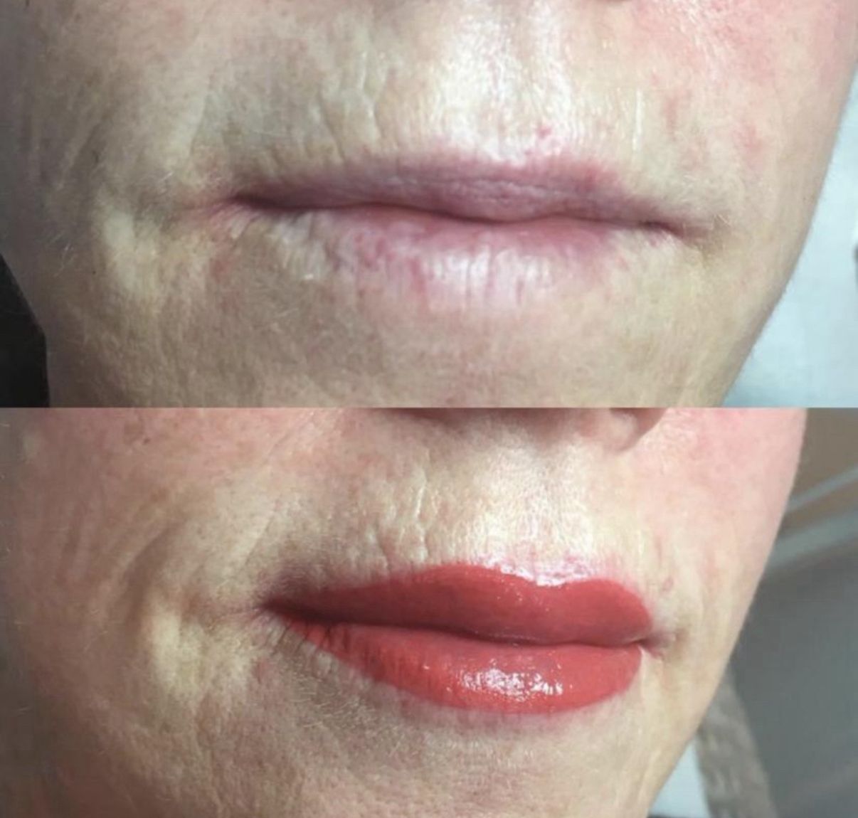 Lips After