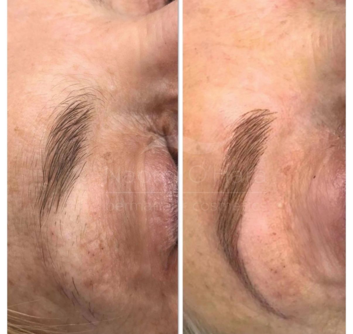 Brows After
