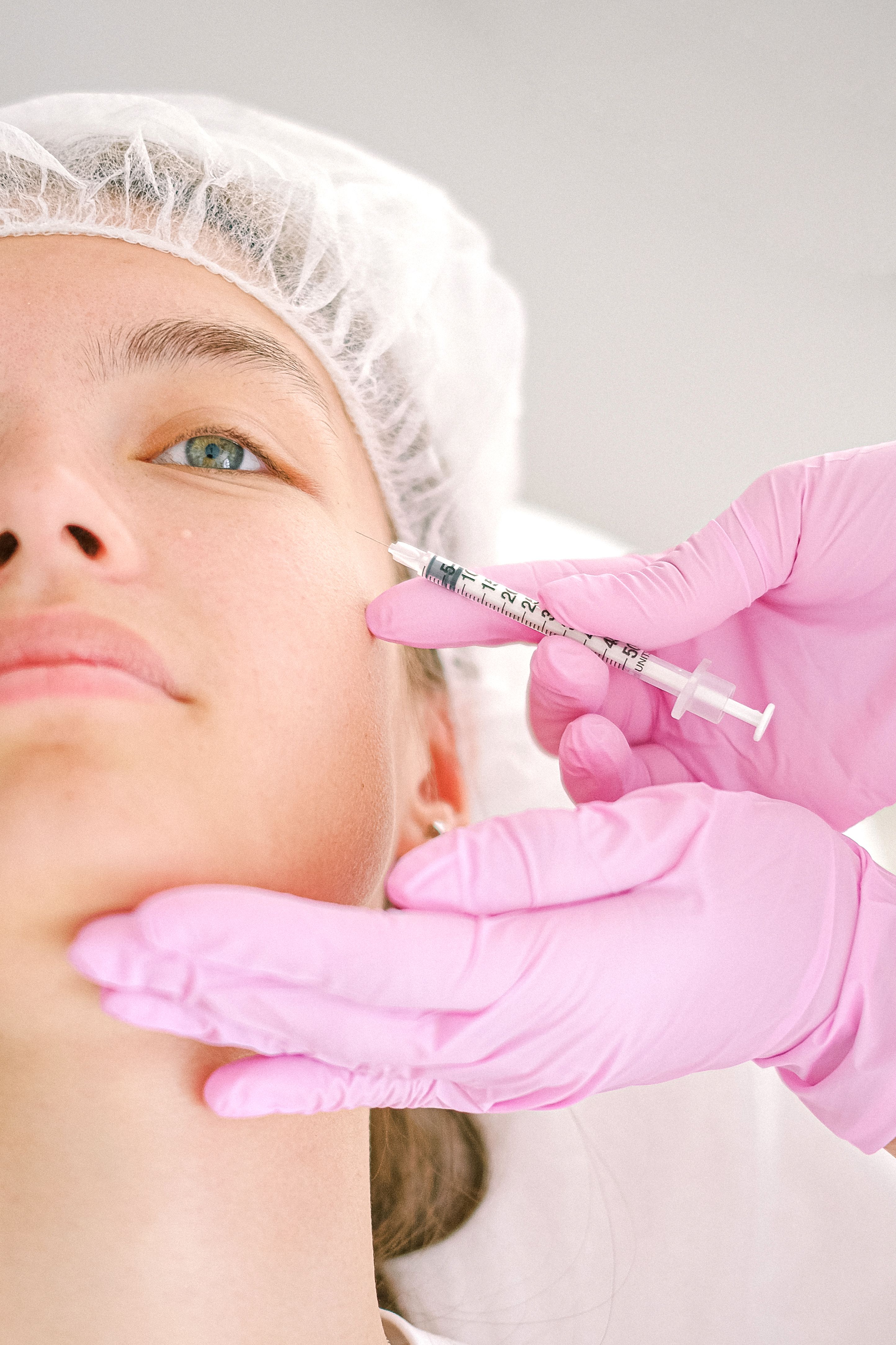 Radiesse treatment at Central Medical Center
