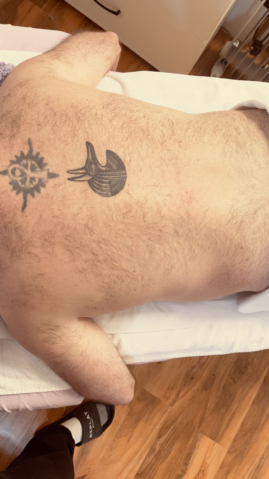 Real client back before waxing, untreated, at Male Waxing London Harlesden studio