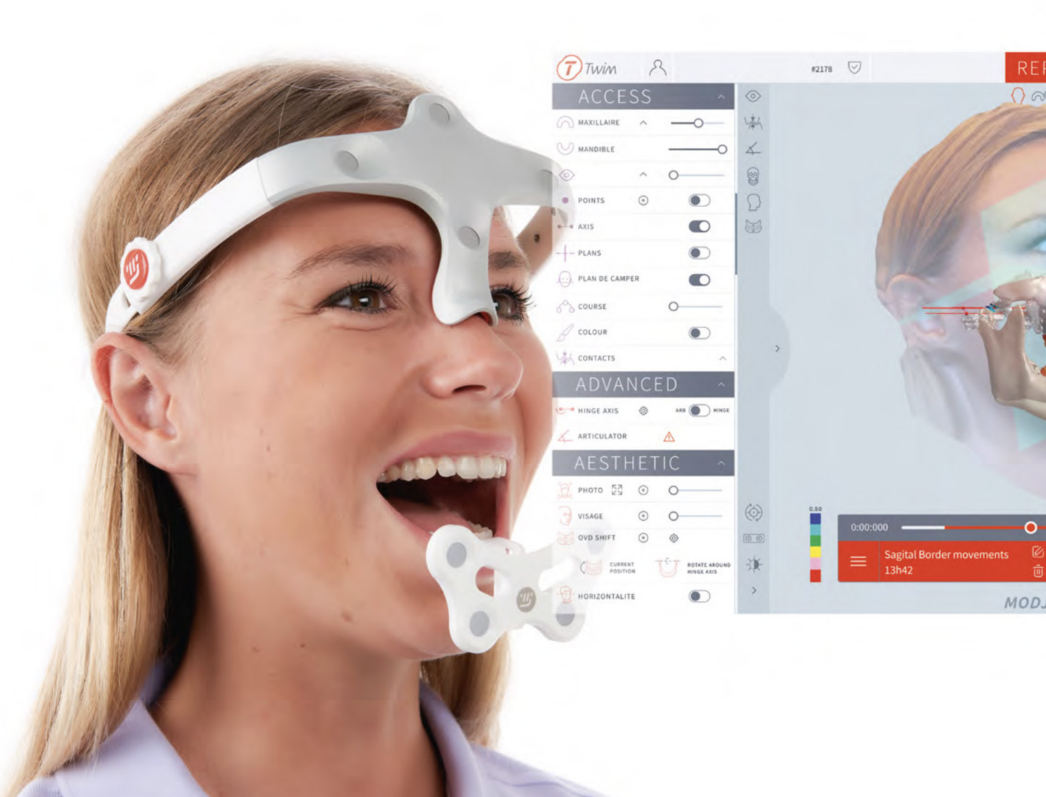 Bite Analysis and TMJ