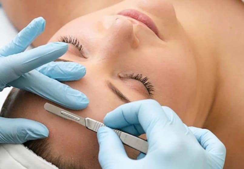 dermaplaning Sussex WI dermaplaning Sussex WI
