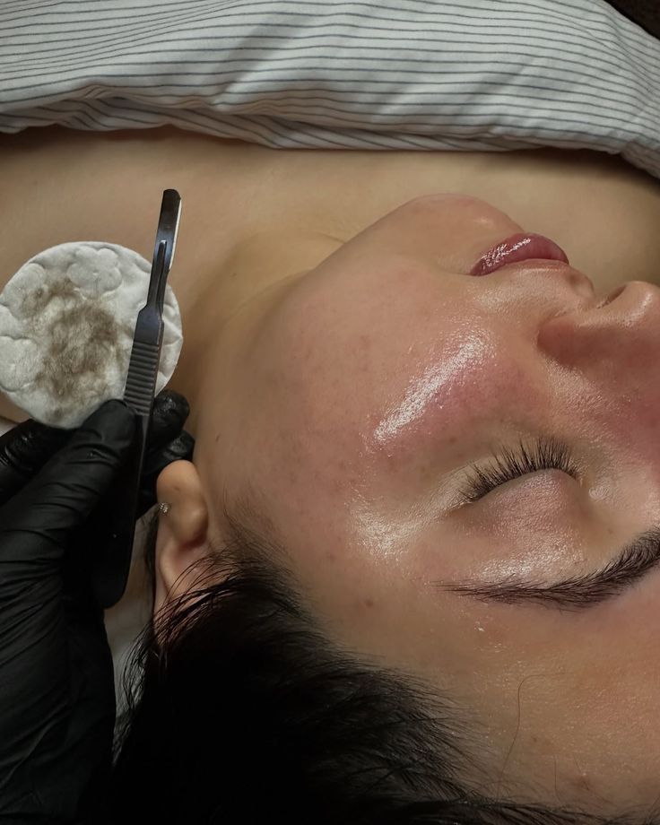 facial vs dermaplaning facial vs dermaplaning