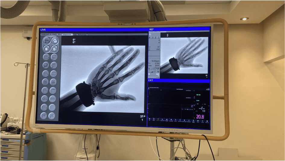 Best Care cath lab project