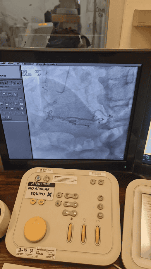 Best Care cath lab project