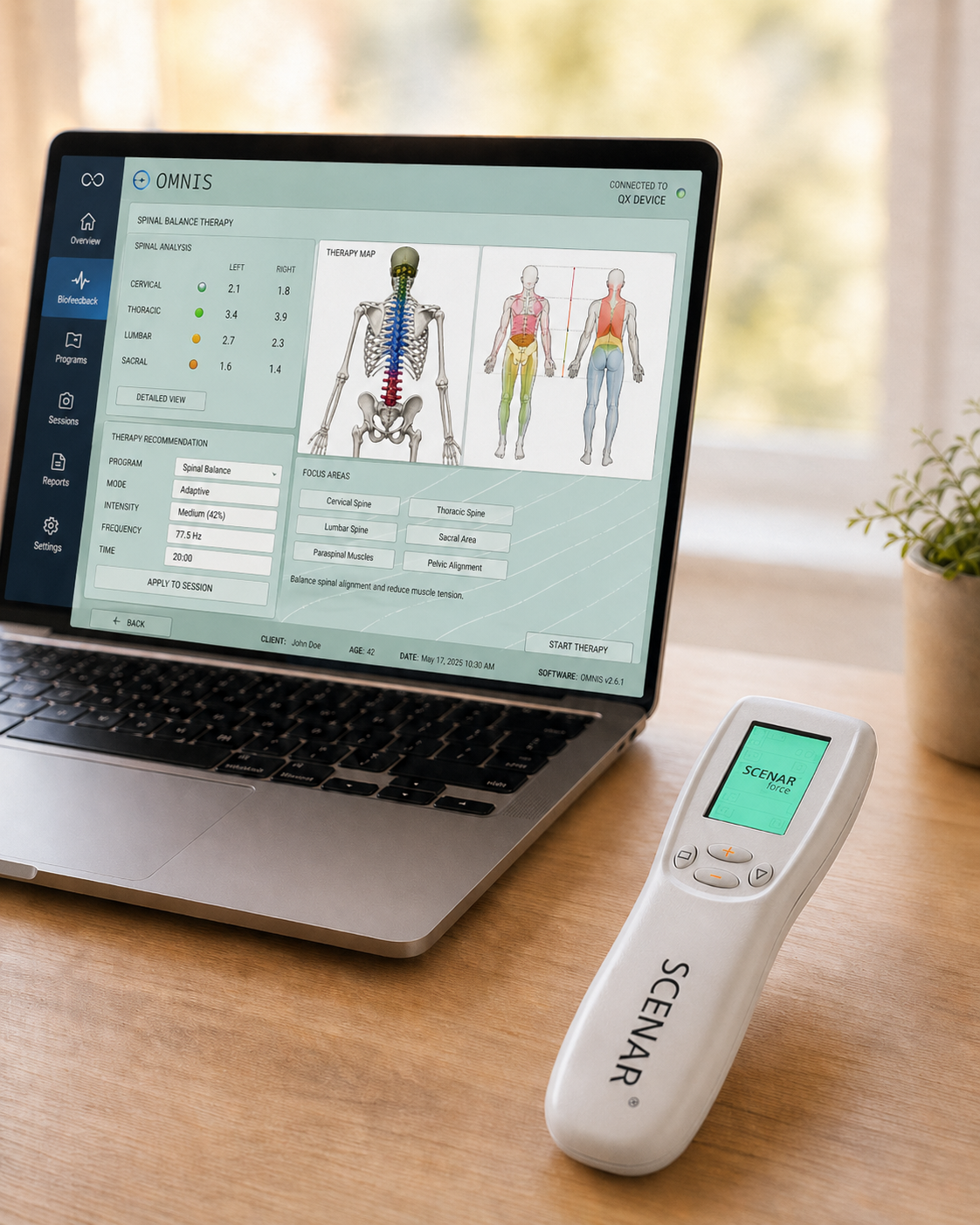 Biofeedback and SCENAR