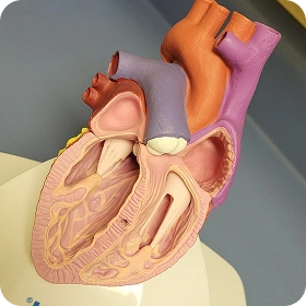 Previous Heart Event