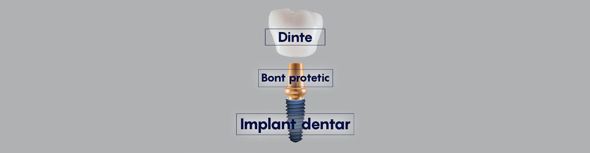 Structura implantului dentar