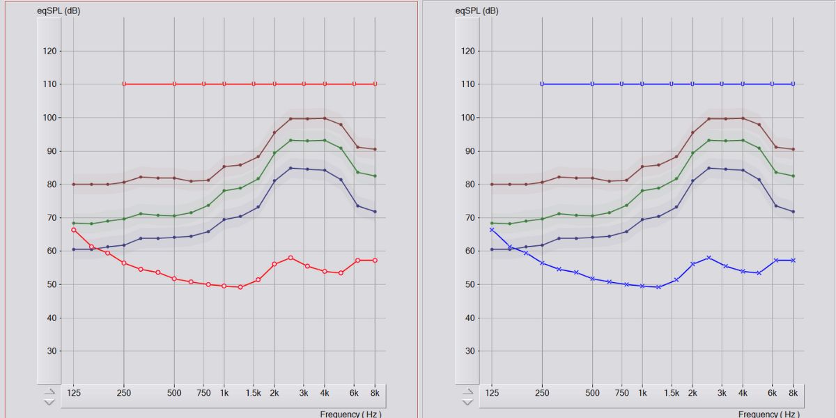 screenshot of hearing test results