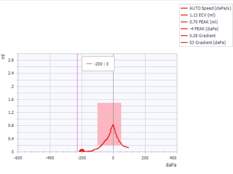 screenshot of hearing test results