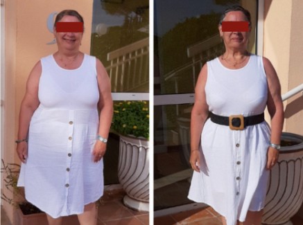 Transformation Avant Après