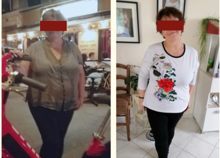 Transformation Avant Après