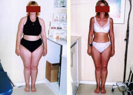 Transformation Avant Après