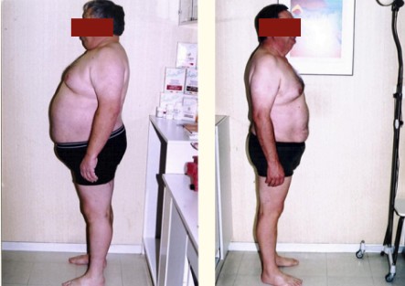 Transformation Avant Après