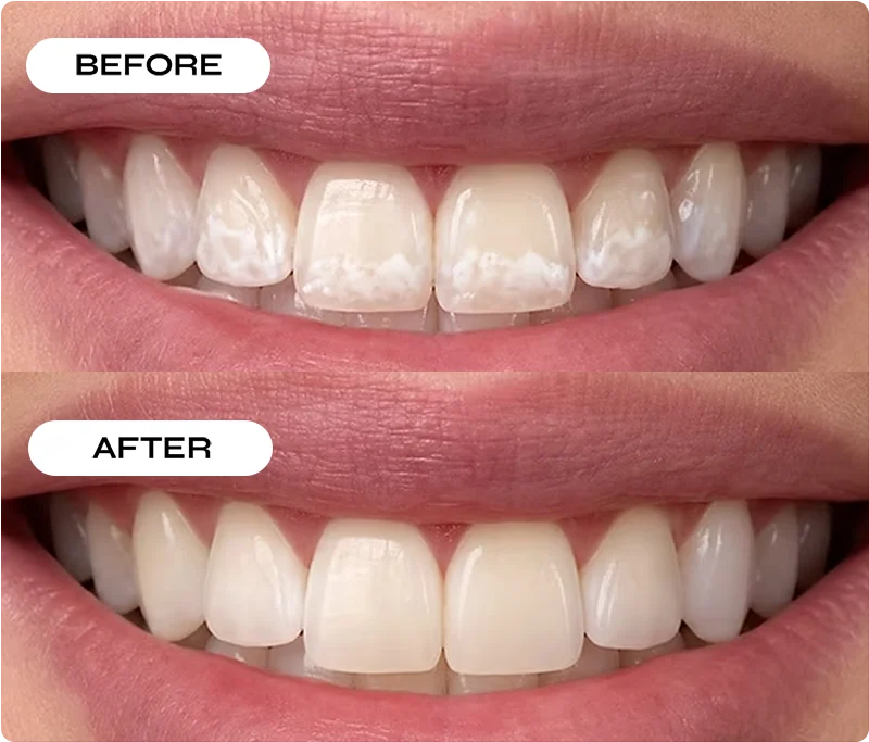 before after