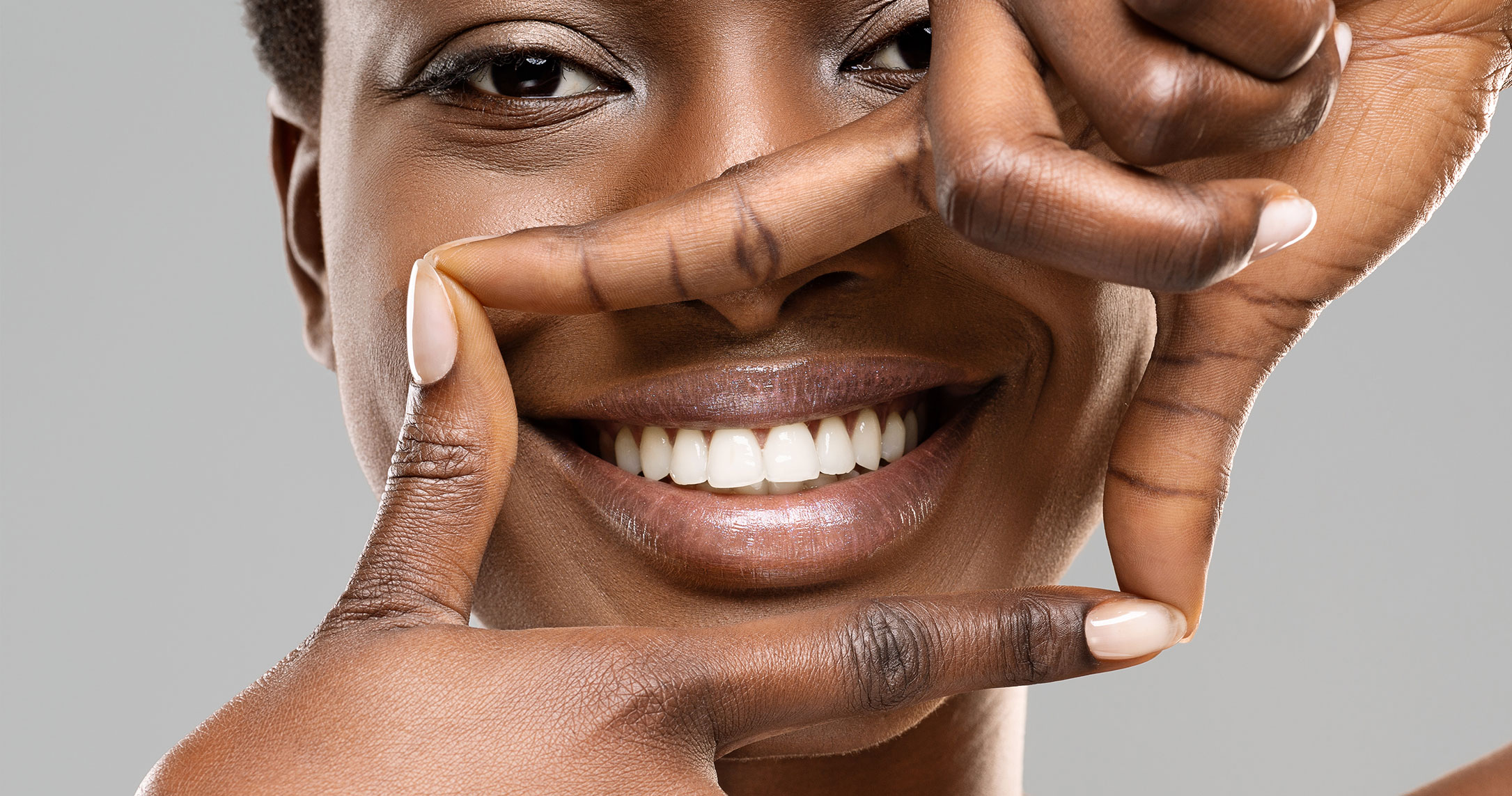 Woman with teeth whitening