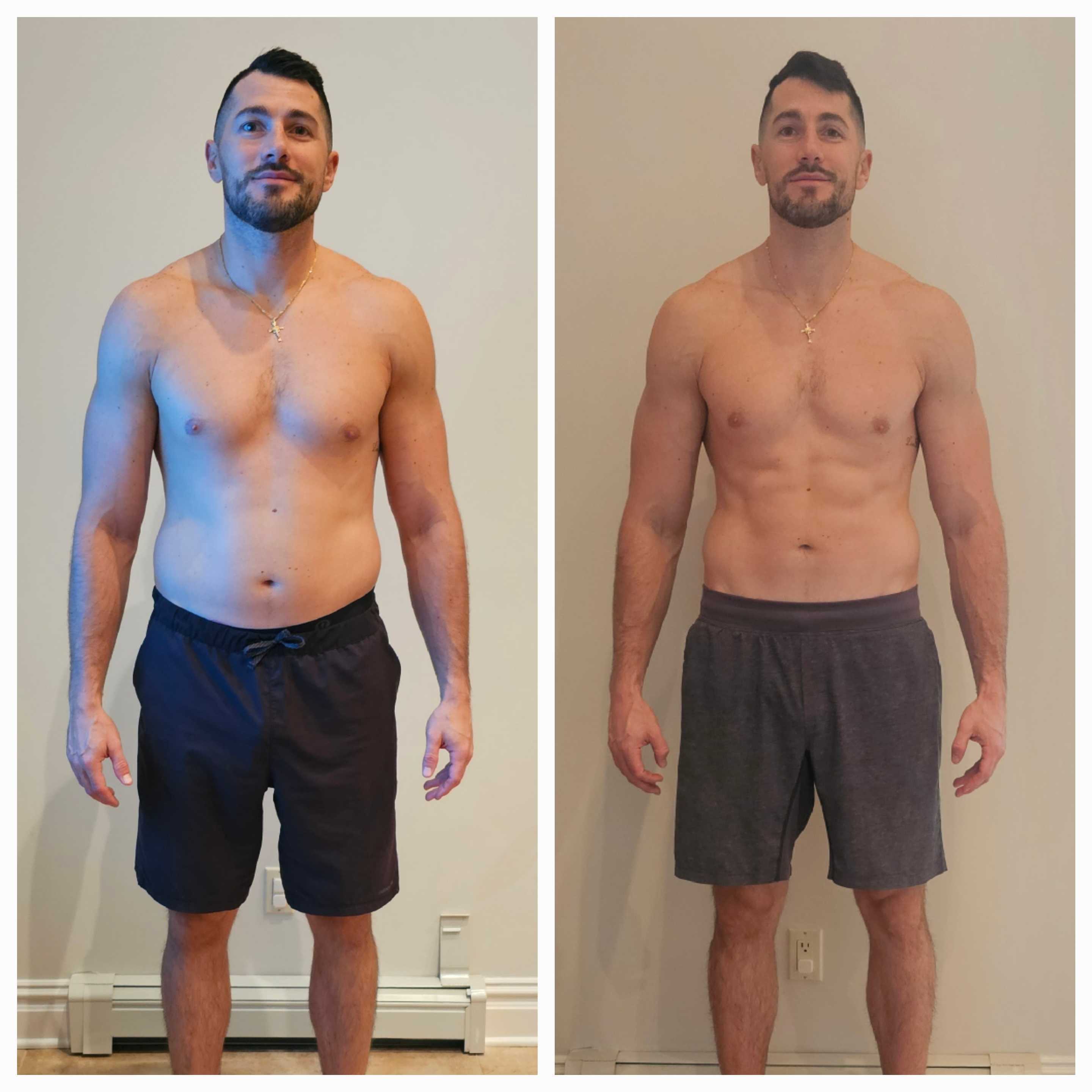 Patient before and after result