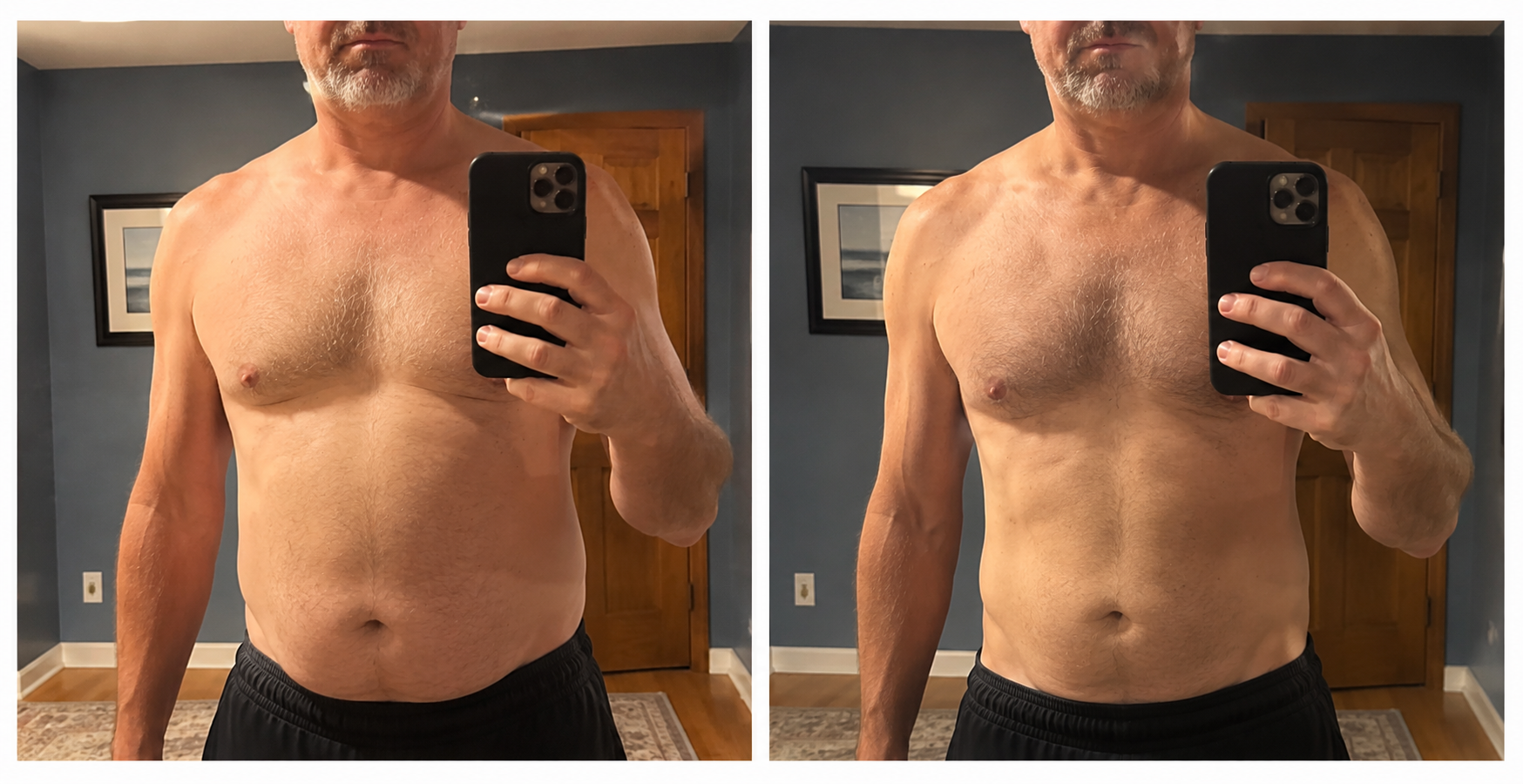 Patient before and after result