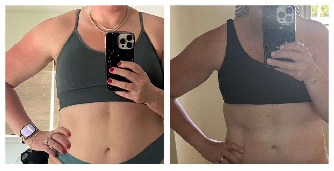 Patient before and after result