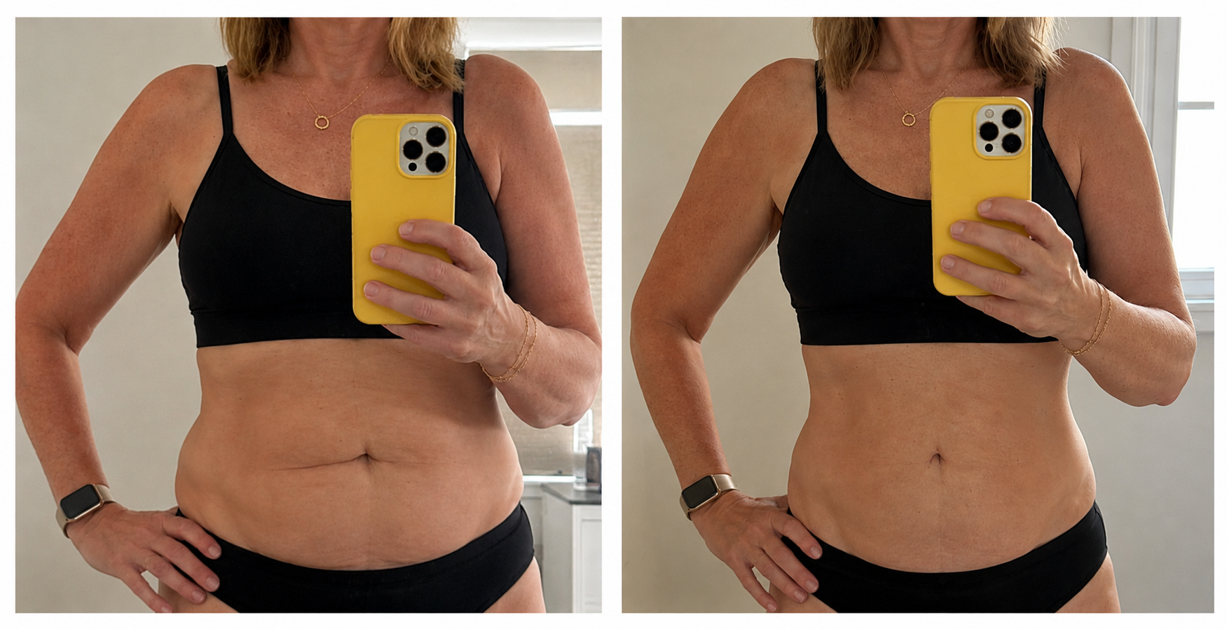 Patient before and after result