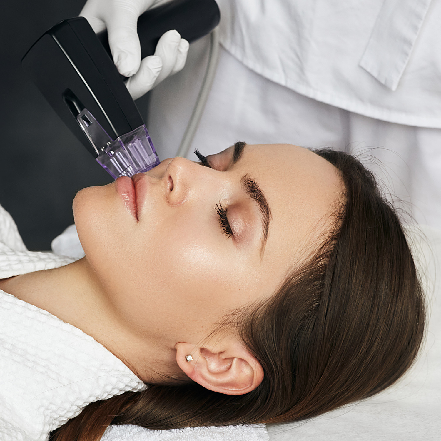 RF Microneedling