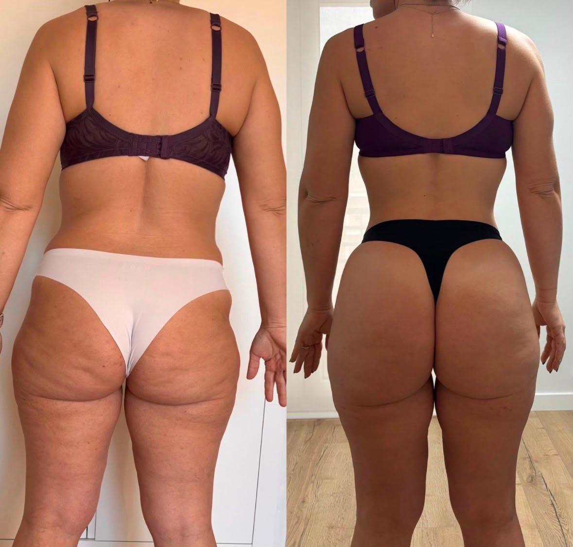 Inés — antes y después 3