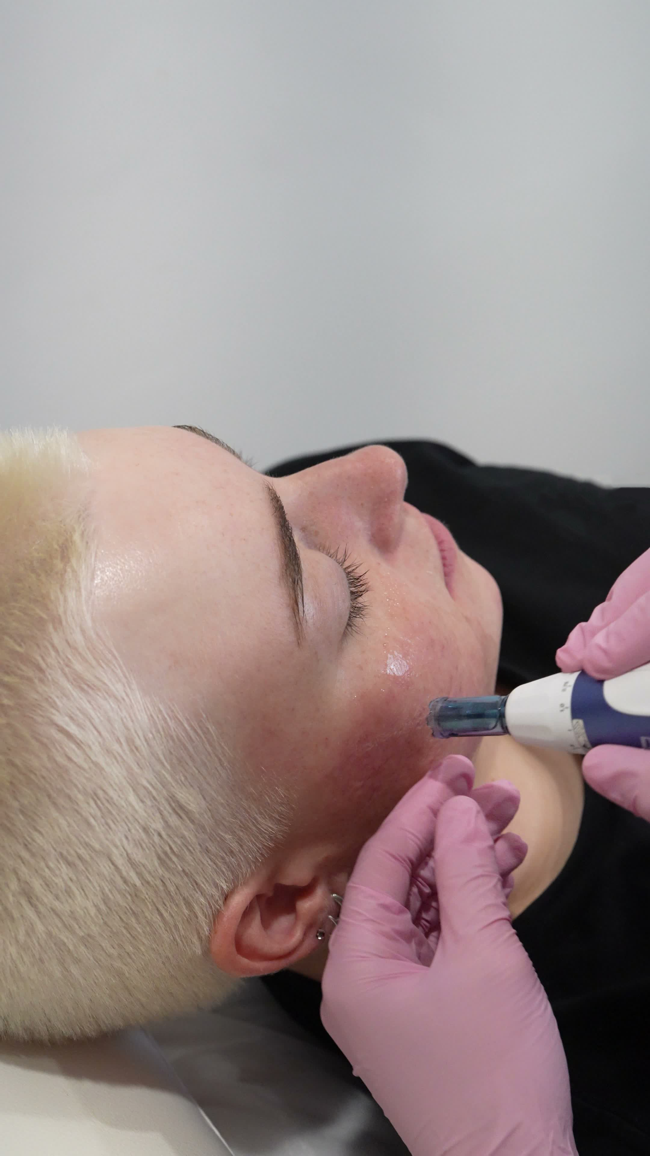 A skin treatment device being used during a facial at NDI Cosmetic Nurse