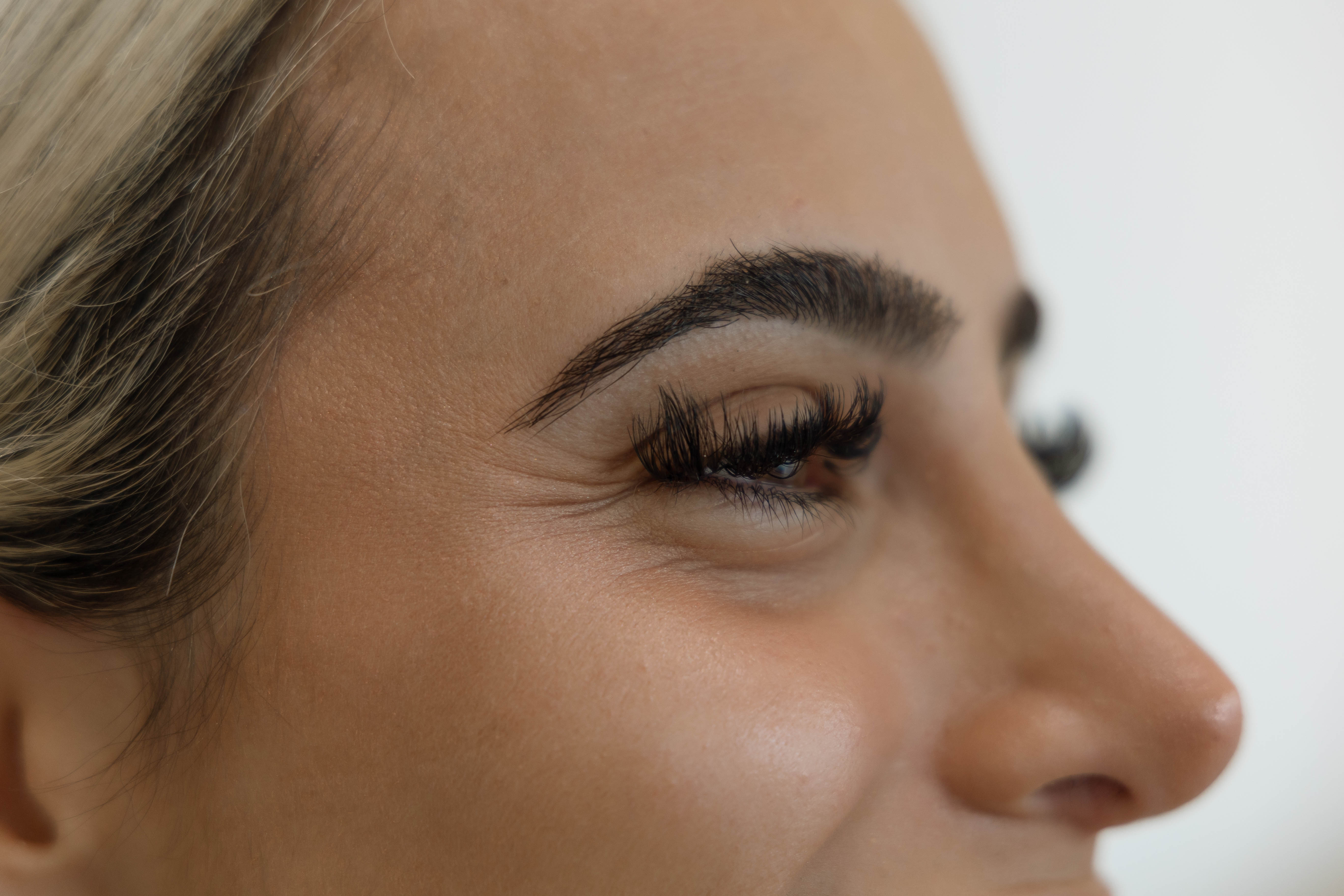 Treatment to the upper face in progress