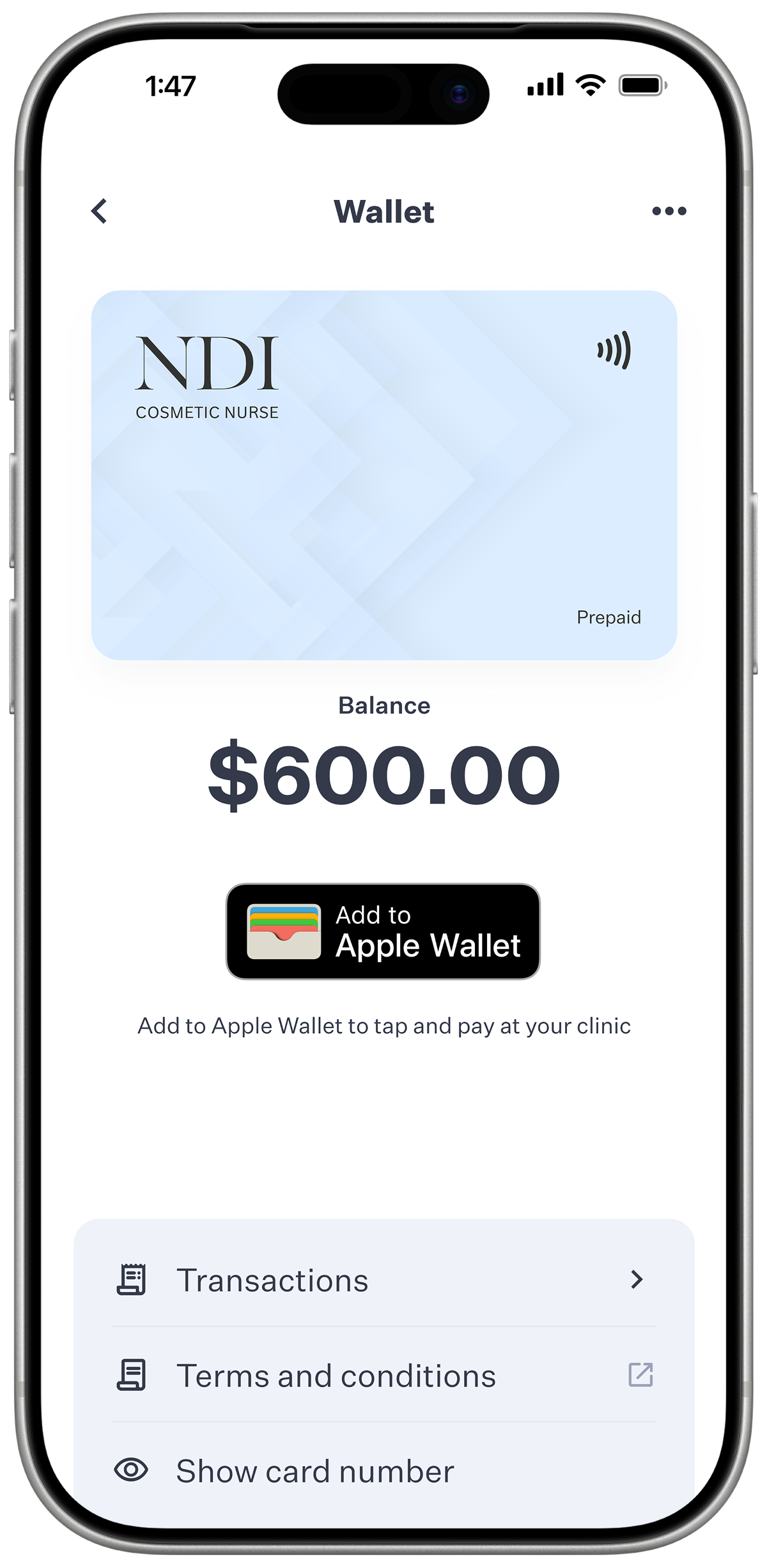 The NDI Treatment Wallet card and $600 balance shown in the Apple Wallet app