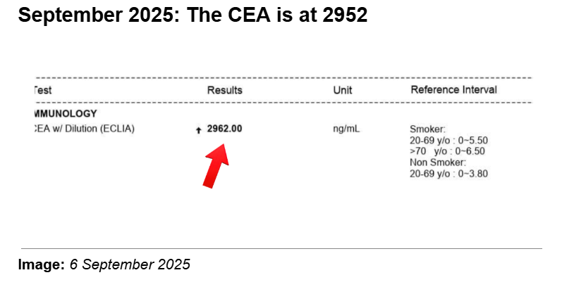 Jack's blood test from 6 September 2025 showing CEA tumour marker at 2,952