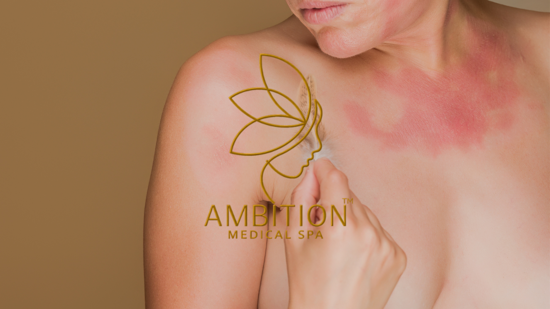Sensitive skin with redness and irritation on face, treated with gentle calming skincare at Ambition Medical Spa