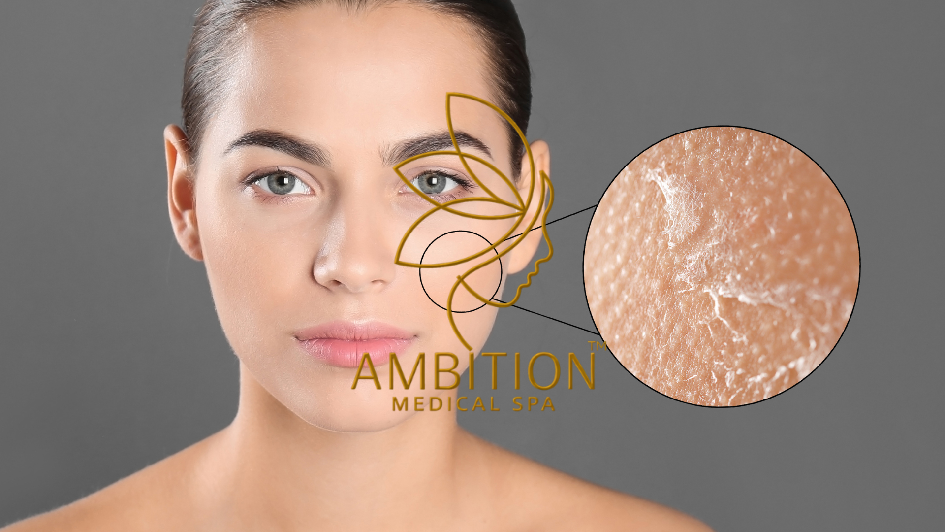 Flaky and dry skin with visible peeling and irritation, treated with hydrating skincare at Ambition Medical Spa