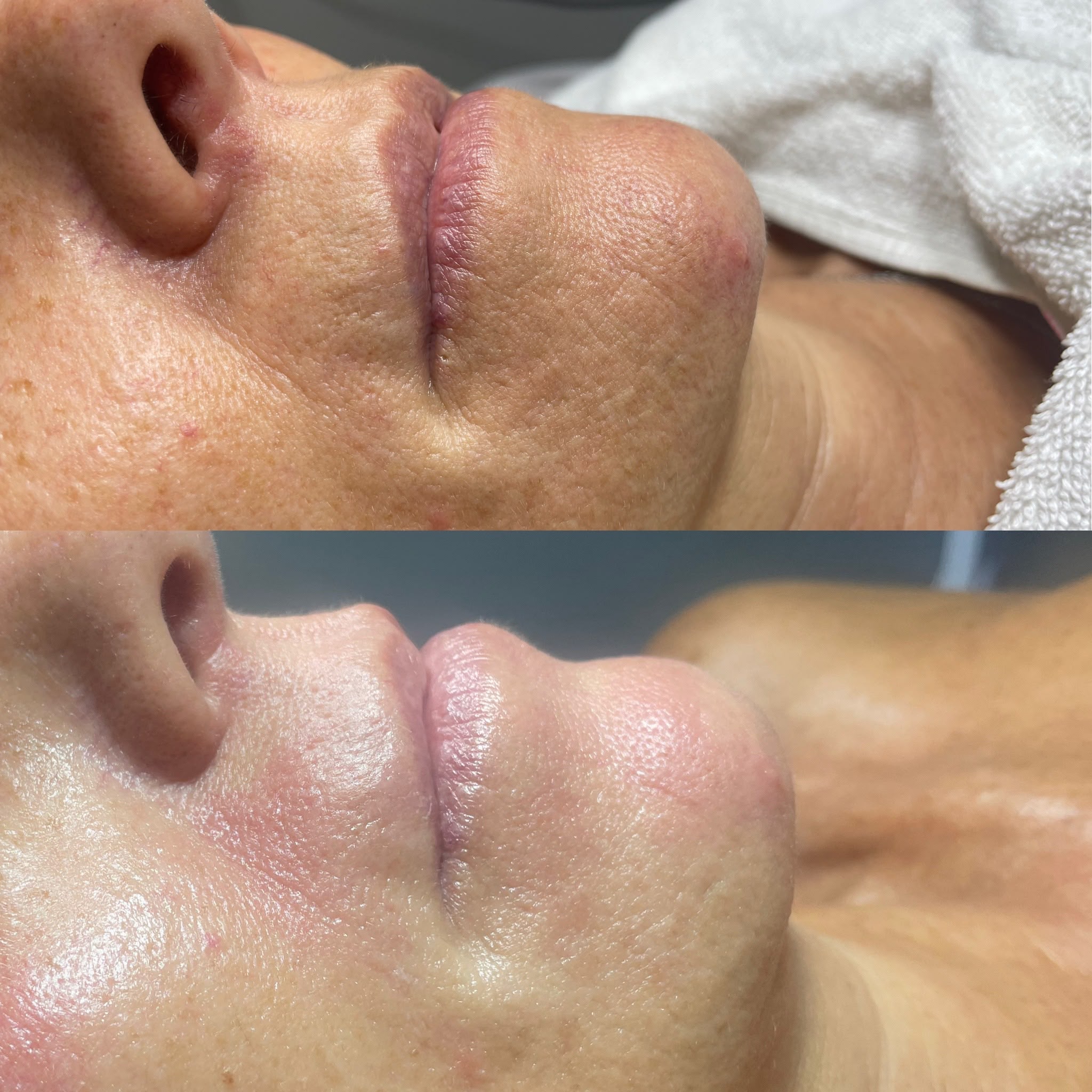Resultado de tratamientos faciales 7