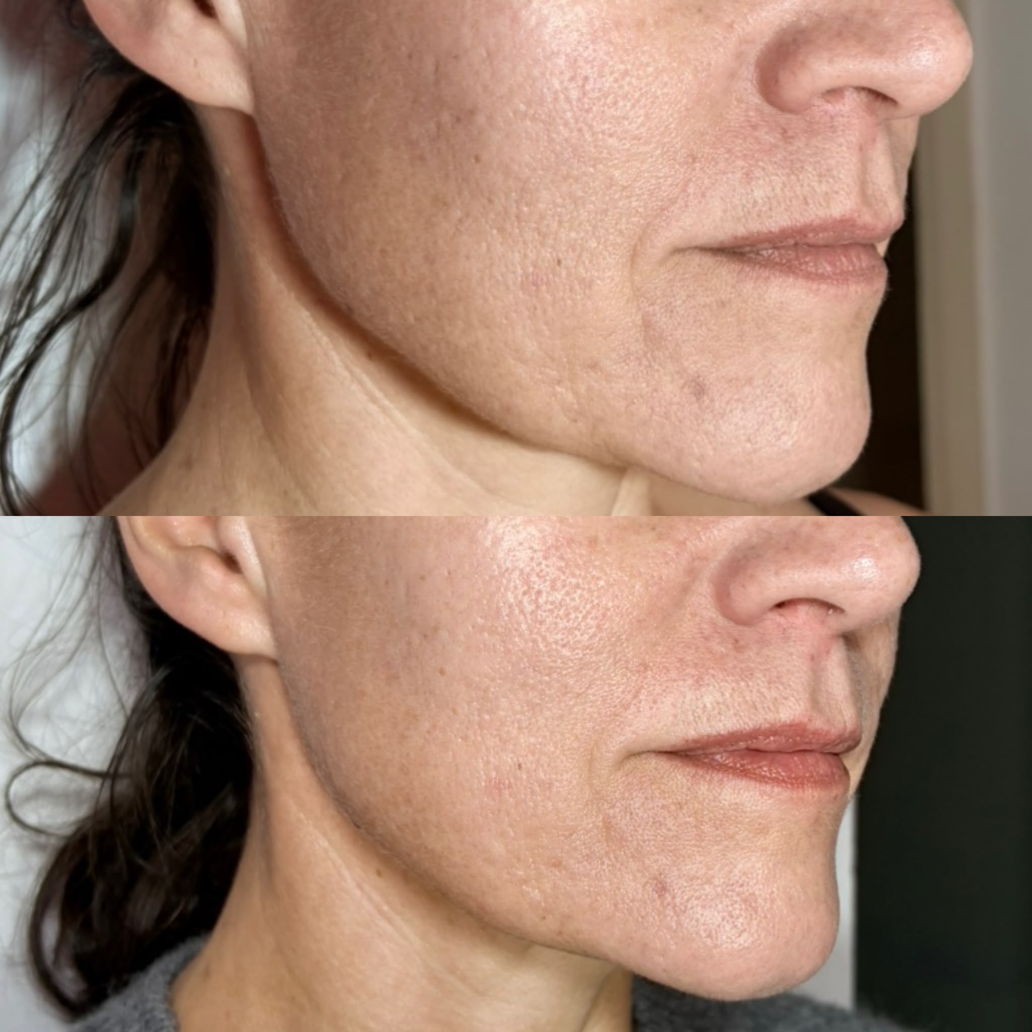 Resultado de tratamientos faciales 10