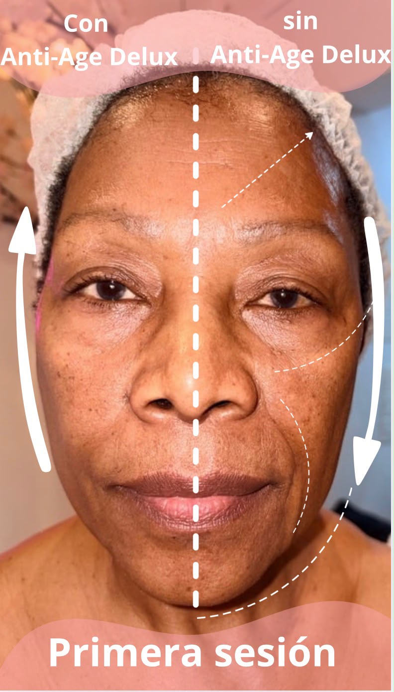 Resultado de tratamientos faciales 12