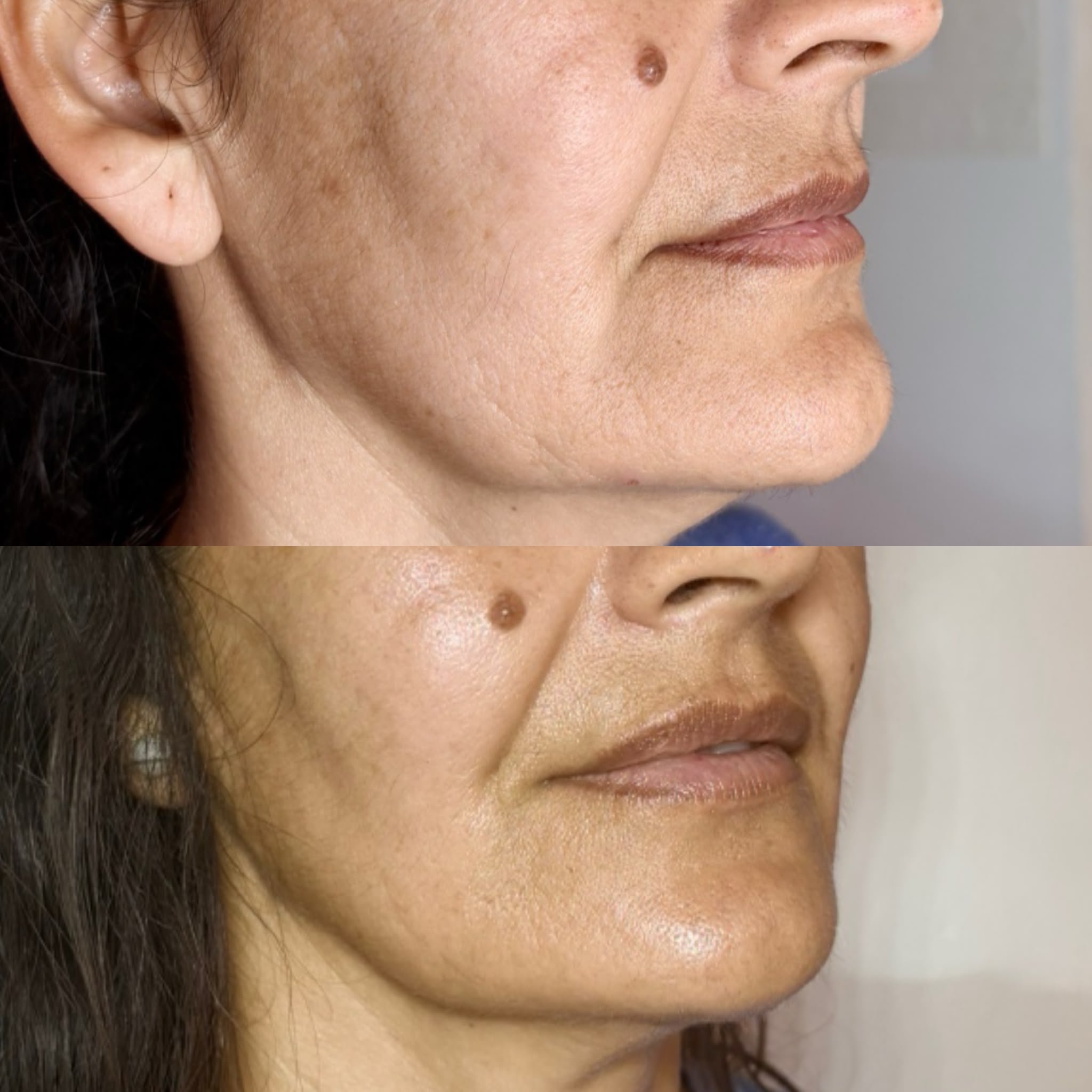 La experiencia facial de GFashion