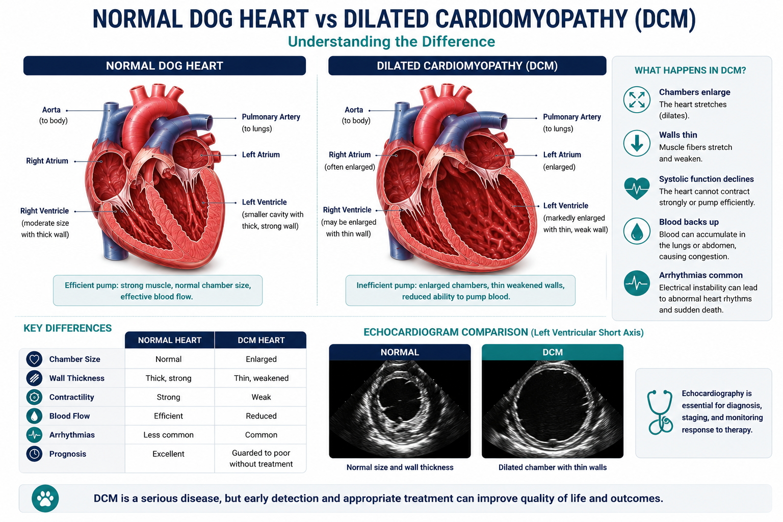 Dilated Cardiomyopathy Echocardiogram