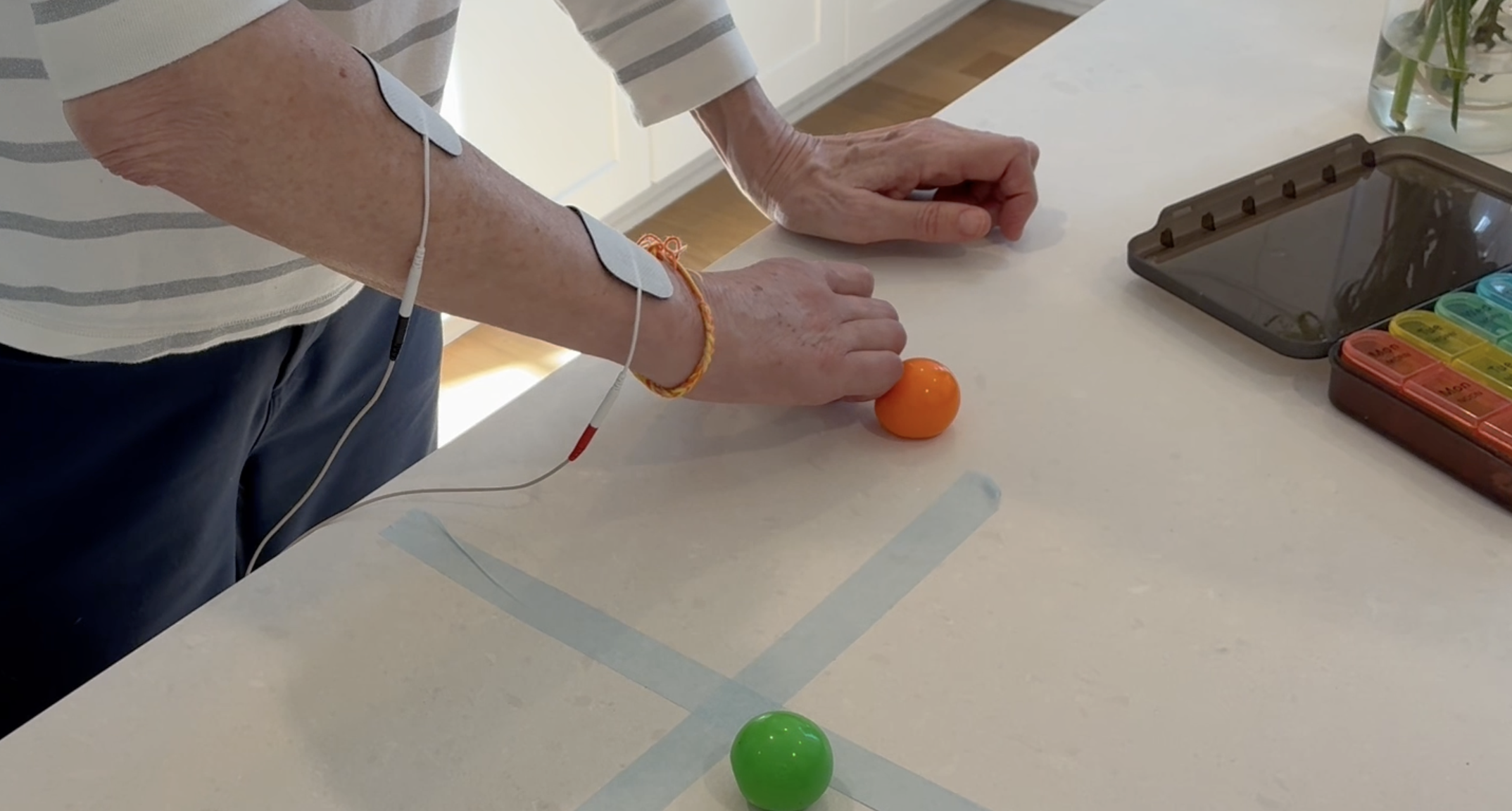 Patient doing a fine-motor tabletop exercise with colored balls while wearing electrical stimulation electrodes during in-home occupational therapy.