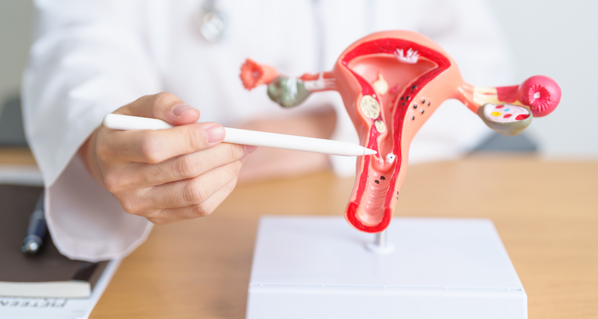 dr explaining endometriosis to a patient