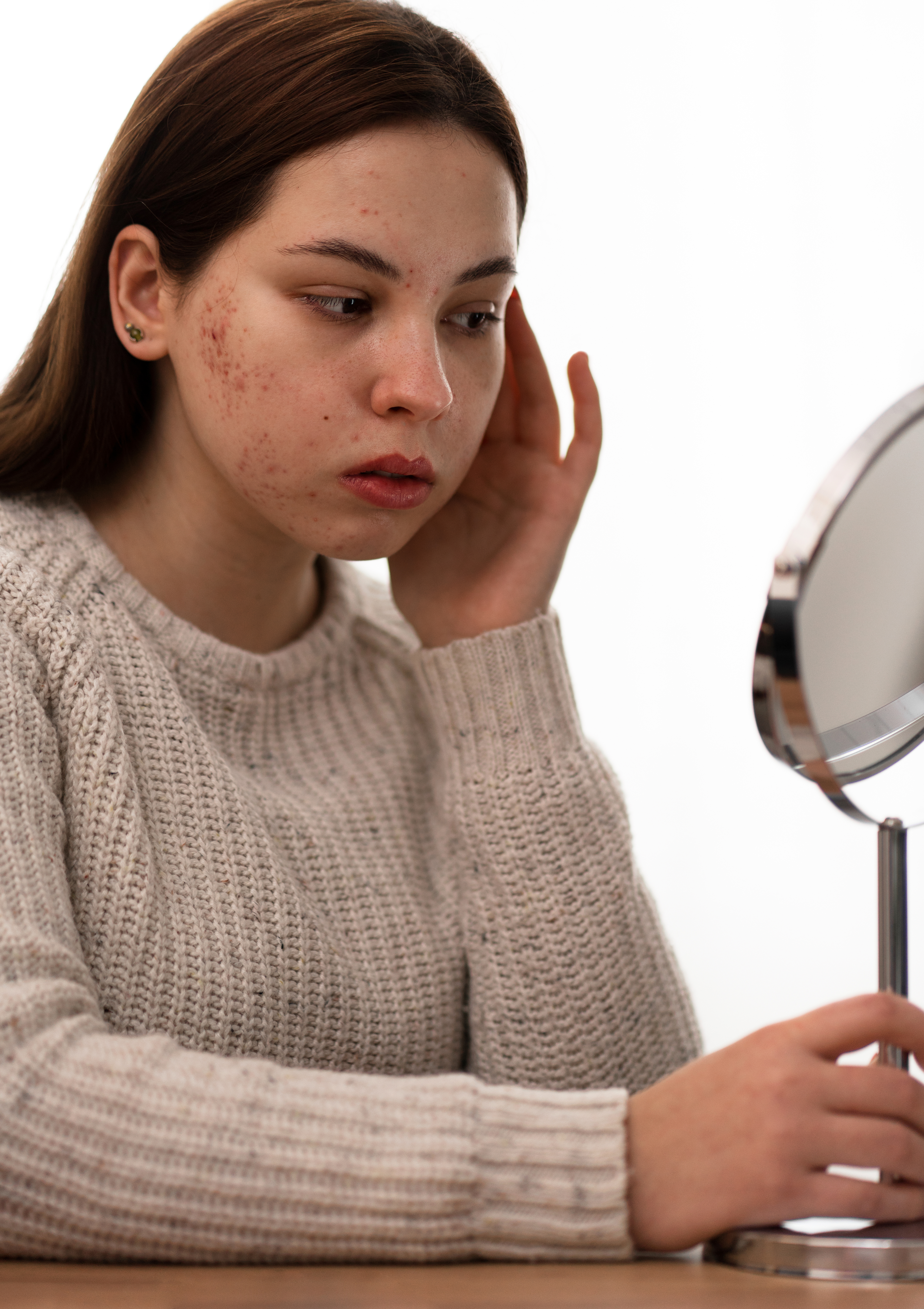 Acne Scar Reduction Treatments in Marthandam