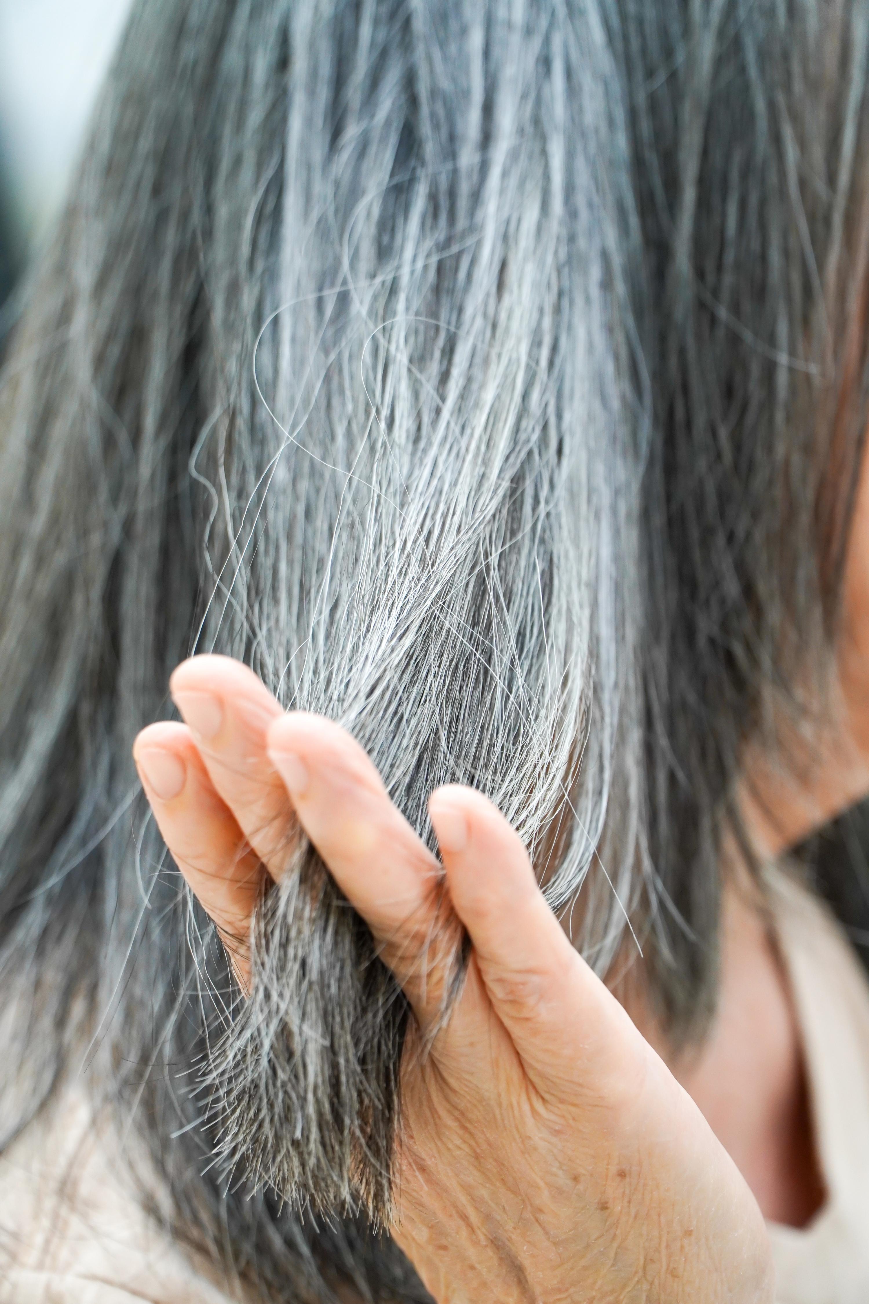 Premature Greying Treatments in Marthandam