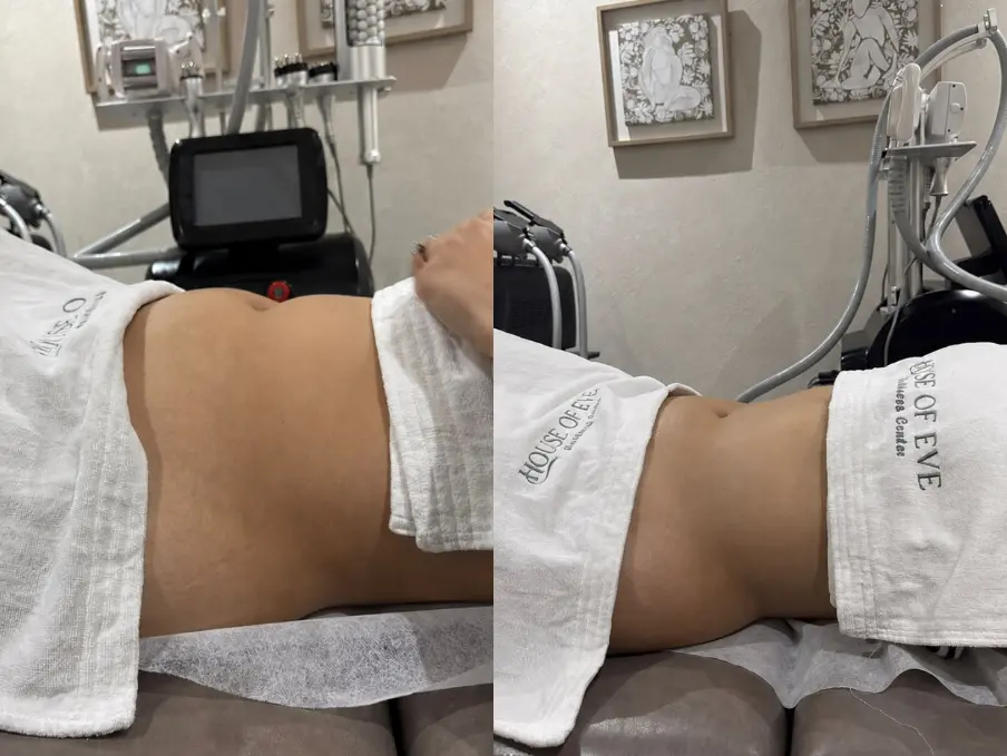 Résultat amincissement ciblé Casablanca
