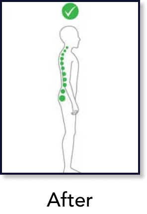 Improved posture after chiropractic care