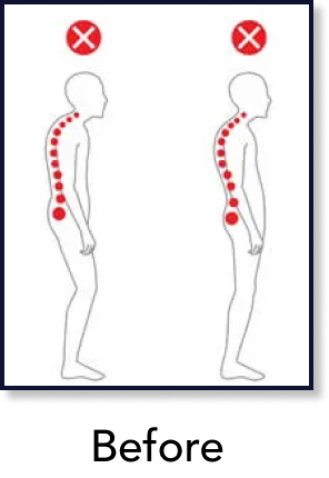 Posture before chiropractic care