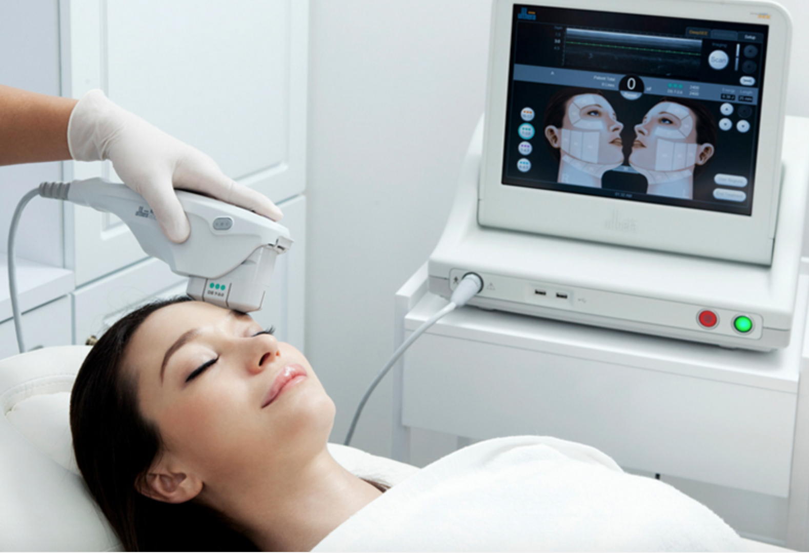 Ultherapy
