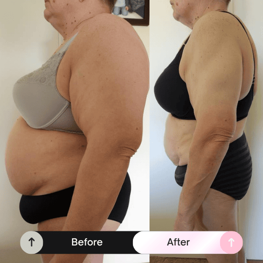 Before and after transformation